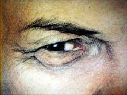 eye.jpg